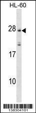 Anti-MS4A5 Rabbit Polyclonal Antibody (HRP (Horseradish Peroxidase))