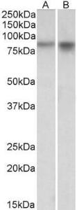 Anti-NPAS4 Antibody (A84910) (1µg/ml) staining of Mouse (A) and Rat (B) Brain lysates (35µg protein in RIPA buffer). Primary incubation was 1 hour. Detected by chemiluminescence.