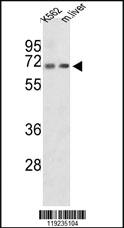 Anti-CROT Rabbit Polyclonal Antibody