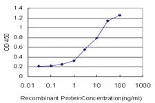 Anti-HSPB1 Mouse Monoclonal Antibody [clone: 3G3]