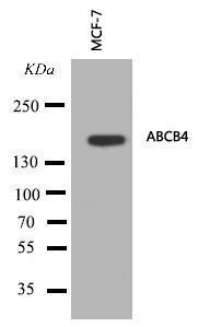 Anti-ABCB4 Rabbit Polyclonal Antibody