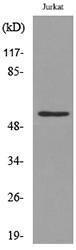 Western blot analysis of lysate from Jurkat cells using Anti-p53 (acetyl Lys372) Antibody