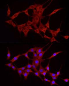 Immunofluorescence analysis of NIH/3T3 cells using Anti-TREM2 Antibody (A8628) at a dilution of 1:50 (40x lens). DAPI was used to stain the cell nuclei (blue)