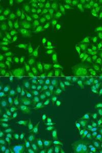 Immunofluorescence analysis of U2OS cells using Anti-PTEN Antibody (A93003) at a dilution of 1:100. DAPI was used to stain the cell nuclei (blue).