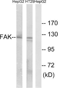 Western blot analysis of lysates from HepG2 and HT-29 cells using Anti-FAK Antibody. The right hand lane represents a negative control, where the antibody is blocked by the immunising peptide