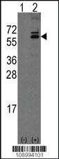 Anti-OLFM1 Rabbit Polyclonal Antibody