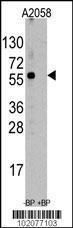 Anti-HSC70 Interacting Protein Rabbit Polyclonal Antibody (AP (Alkaline Phosphatase))