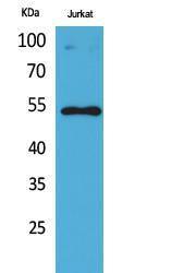 Western blot analysis of Jurkat cells using Anti-p53 (acetyl Lys372) Antibody