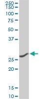 Anti-CNOT7 Mouse Monoclonal Antibody [clone: 2F6]