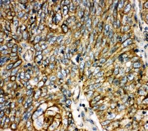 Anti-Aquaporin 6 Rabbit Polyclonal Antibody