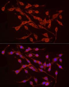 Immunofluorescence analysis of PC-12 cells using Anti-TREM2 Antibody (A8628) at a dilution of 1:50 (40x lens). DAPI was used to stain the cell nuclei (blue)