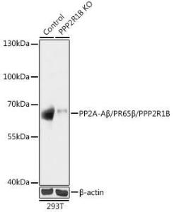 Western blot analysis of extracts from normal (control) and PP2A-Abeta/PR65beta/PP2A-Abeta/PR65beta/PPP2R1B knockout (KO) 293T cells, using Anti-PPP2R1B Antibody (A93004) at 1:1,000 dilution