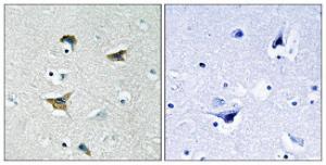 Immunohistochemical analysis of paraffin-embedded human brain tissue using Anti-FAK Antibody. The right hand panel represents a negative control, where the antibody was pre-incubated with the immunising peptide