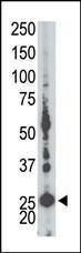 Anti-AK5 Rabbit Polyclonal Antibody (APC (Allophycocyanin))