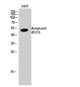 Western blot analysis of 293T cells using Anti-p53 (acetyl Lys372) Antibody