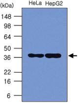 Anti-NPM Mouse Monoclonal Antibody [clone: 5E3]