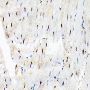 Immunohistochemistry analysis of paraffin-embedded rat heart using Anti-SF3B3 Antibody [ARC1667] (A309080) at a dilution of 1:100 (40X lens). Perform microwave antigen retrieval with 10 mM Tris/EDTA buffer pH 9.0 before commencing with IHC staining protocol