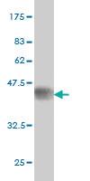 Anti-UTRN Mouse Monoclonal Antibody [clone: 5G6]