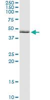 Anti-ALDH3B1 Antibody Pair