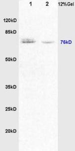 Anti-DVL1 Rabbit Polyclonal Antibody