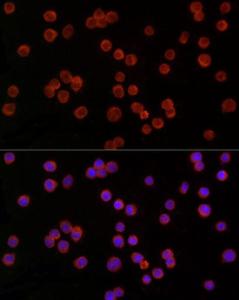 Immunofluorescence analysis of THP-1 cells using Anti-TREM2 Antibody (A8628) at a dilution of 1:50 (40x lens). DAPI was used to stain the cell nuclei (blue)