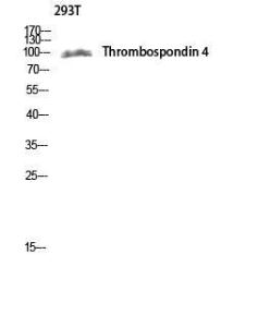 Western blot analysis of 293T lysis using Anti-THBS4 Antibody