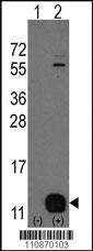 Anti-KDM4B Rabbit Polyclonal Antibody