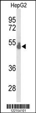 Anti-KLK9 Rabbit Polyclonal Antibody