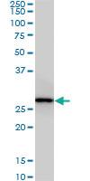 Anti-CNOT7 Mouse Monoclonal Antibody [clone: 2F6]