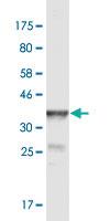 Anti-POGK Mouse Monoclonal Antibody [clone: 2D3]