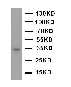 Anti-Aquaporin 10 Rabbit Polyclonal Antibody