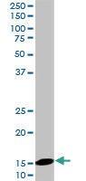 Anti-UBE2D2 Mouse Monoclonal Antibody [clone: 4A1]