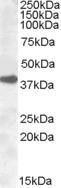 Anti-ERCC1 Antibody (A83297) (03 µg/ml) staining of A431 lysate (35 µg protein in RIPA buffer) Primary incubation was 1 hour Detected by chemiluminescence