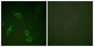 Immunofluorescence analysis of HeLa cells using Anti-FAK Antibody. The right hand panel represents a negative control, where the antibody was pre-incubated with the immunising peptide