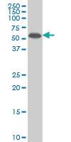 Anti-MAP2K5 Mouse Monoclonal Antibody [clone: 3E10]