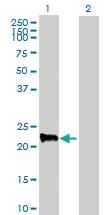 Anti-MRPS27 Mouse Polyclonal Antibody