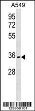 Anti-OR51B6 Rabbit Polyclonal Antibody (FITC (Fluorescein Isothiocyanate))