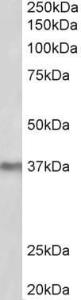 Anti-POLDIP2 Antibody (A84914) (2µg/ml) staining of Mouse Liver lysate (35µg protein in RIPA buffer). Primary incubation was overnight at 4C. Detected by chemiluminescence.