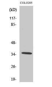 Western blot analysis of various cells using Anti-OR52D1 Antibody