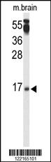 Anti-PPP3R2 Rabbit Polyclonal Antibody