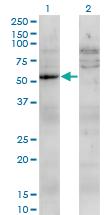 Anti-UMPS Mouse Monoclonal Antibody [clone: 2F5]