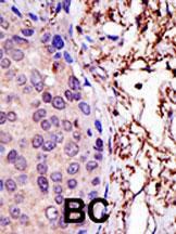 Anti-UBE2L3 Rabbit Polyclonal Antibody (AP (Alkaline Phosphatase))