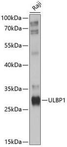 Western blot analysis of extracts of Raji cells, using Anti-ULBP1 Antibody (A8629) at 1:1,000 dilution The secondary antibody was Goat Anti-Rabbit IgG H&L Antibody (HRP) at 1:10,000 dilution Lysates/proteins were present at 25 µg per lane