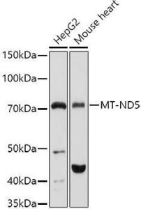 Western blot analysis of extracts of various cell lines, using Anti-MT-ND5 Antibody (A93006) at 1:1,000 dilution. The secondary antibody was Goat Anti-Rabbit IgG H&L Antibody (HRP) at 1:10,000 dilution.