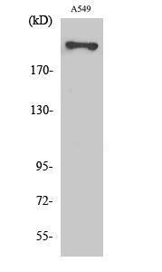 Western blot analysis of various cells using Anti-Fatty Acid Synthase Antibody