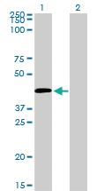 Anti-C5AR1 Mouse Monoclonal Antibody [clone: 4E2]