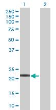 Anti-LYG1 Mouse Polyclonal Antibody