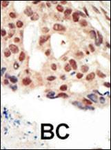 Anti-PRKG2 Rabbit Polyclonal Antibody (Biotin)