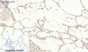 Immunohistochemical analysis of paraffin-embedded human lung tissue using Anti-BCL6 Antibody at 1:200 (4°C overnight) Negative control was secondary antibody only