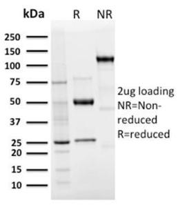 SDS-PAGE analysis of Anti-Langerin Antibody [LGRN/3136R] under non-reduced and reduced conditions; showing intact IgG and intact heavy and light chains, respectively. SDS-PAGE analysis confirms the integrity and purity of the antibody.